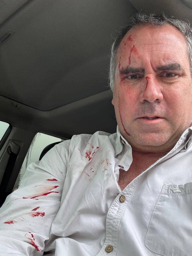 贝劳德遇袭后受轻伤，还向歹徒开枪还击。（图撷取自「X」）