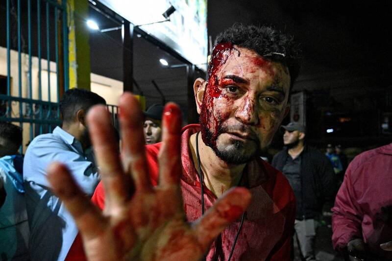 中美洲国家宏都拉斯当局今天表示，左派抗议者发起示威活动，要求公布大选最终结果，警方驱散民众时，至少有8人受伤。图为一名支持者在国家民警和公共秩序军事警察（PMOP）的驱散行动中受伤，并展示了他的伤口。（法新社）