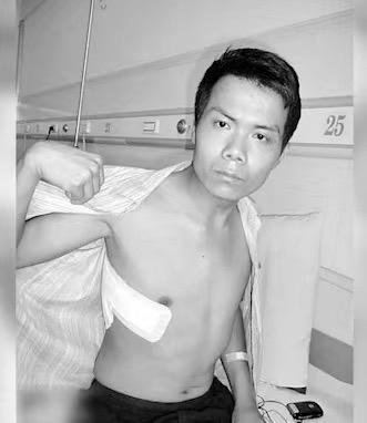 张海超开胸验肺16年后:如今生活一地鸡毛 泪流不止…