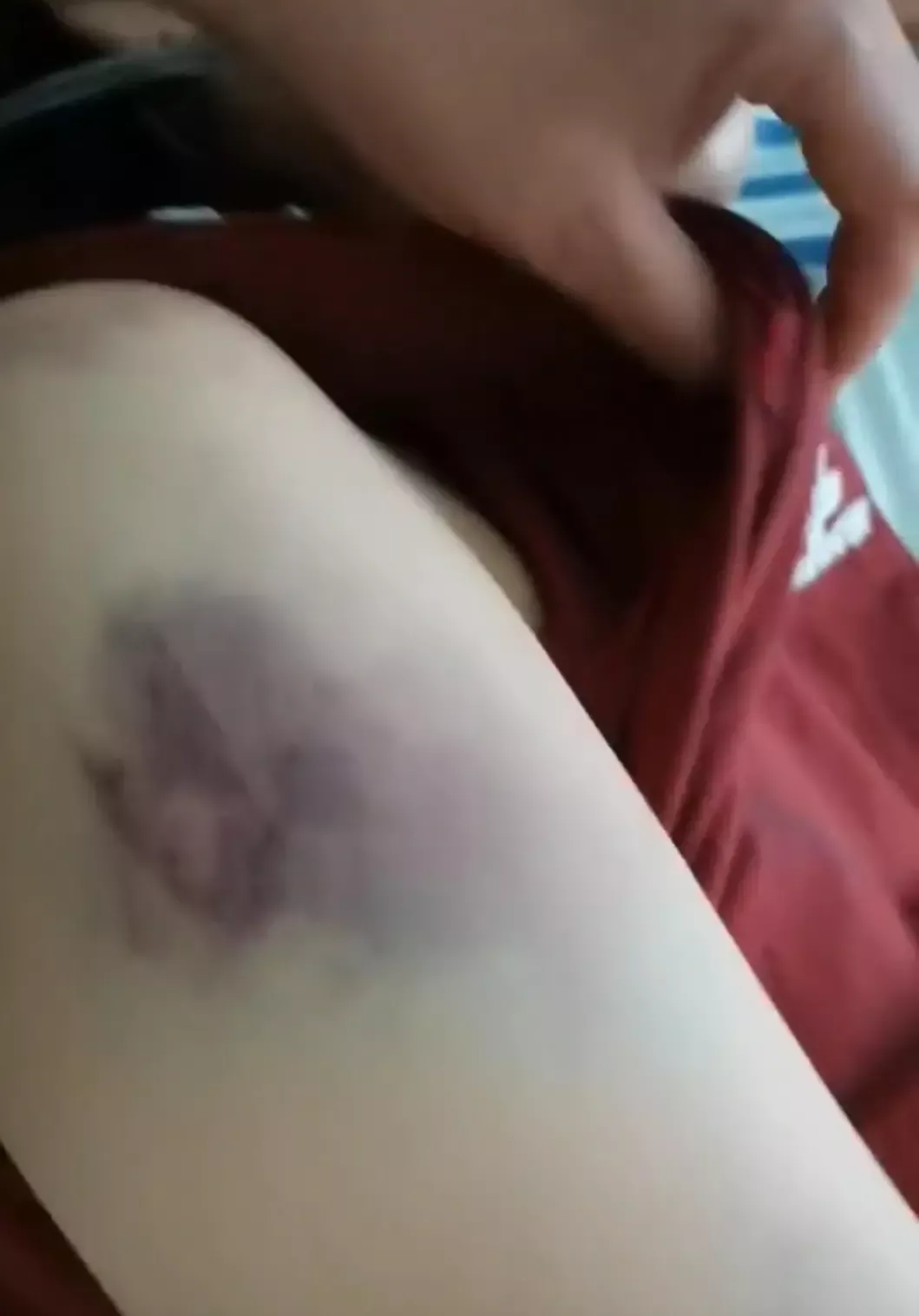 ▲曹某某身上的伤