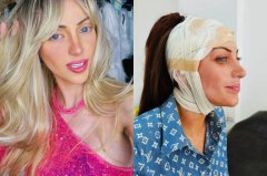 整形27次为成芭比梦！巴西女网红惊传「半裸陈尸」51岁男家中