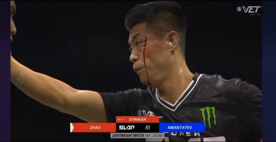 扇耳光大赛赵鸿刚：练了两年通背拳 没想到打成这样