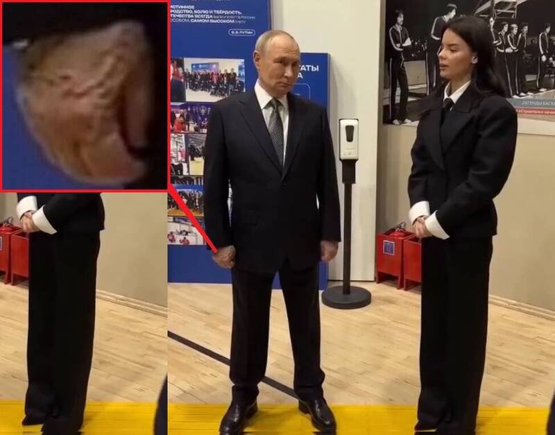 俄罗斯总统普廷近日出席公开活动时，被镜头捕捉到右手手背异常肿胀、血管突起画面。（取自x）