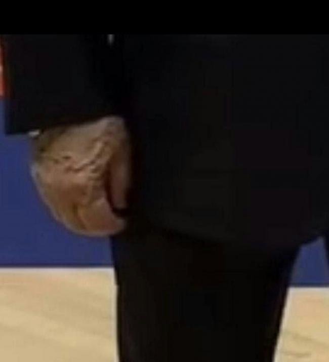 普京“右手”掀热议 再传健康亮红灯 疑患这病 普京“右手”掀热议 再传健康亮红灯 疑患这病