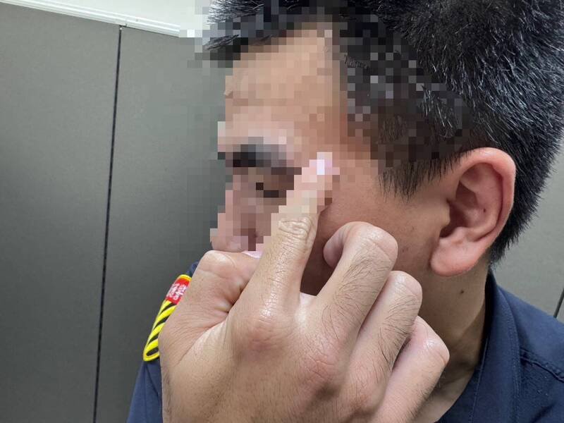 陈姓员警挂彩。（记者郑景议翻摄）