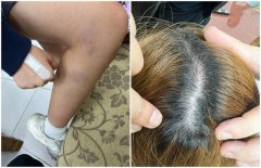 新北高职女遭学长拿刀割发、拖下楼 疑加害者发文反控她找流氓