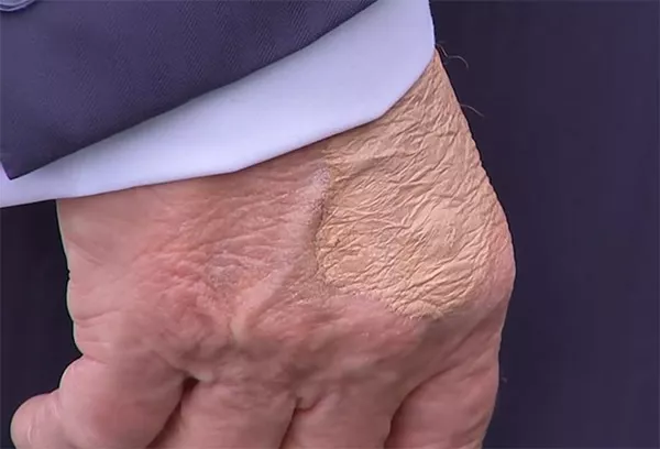 被《纽约时报》指“显露衰老迹象”，特朗普跳脚