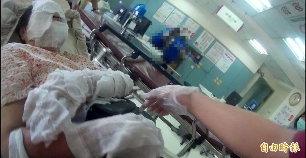 张姓妇人拜拜烧金金纸不慎遭烫伤，送医治疗。（记者丁伟杰摄）